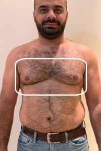 before-2.jpg