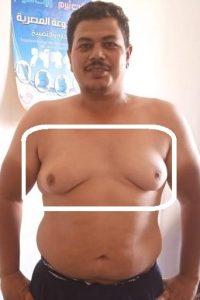 before-3-1.jpg